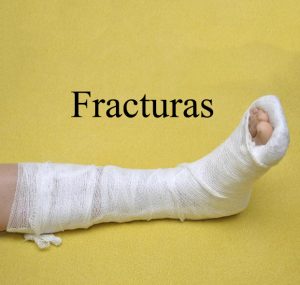 tratamiento-de-fracturas-centro-integral-del-pie